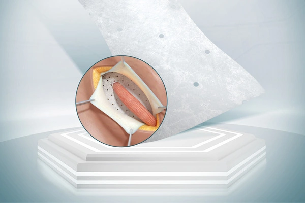 Produk Biological SIS untuk Bedah Umum