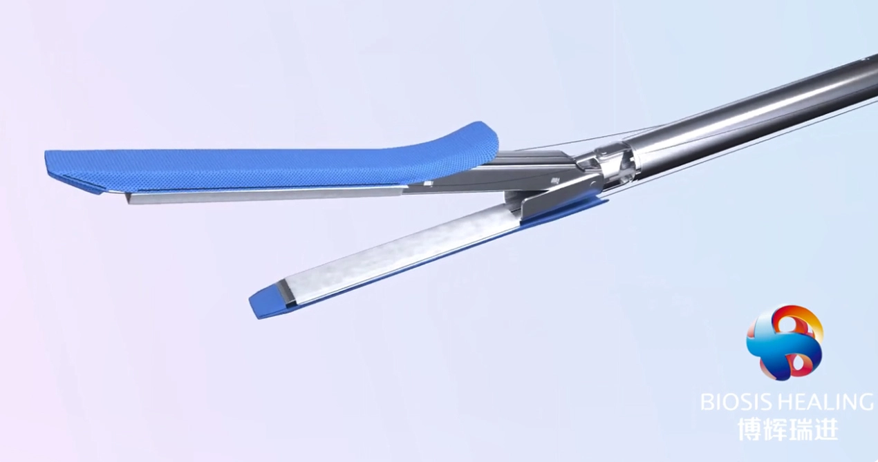 Penguat garis staples untuk operasi bariatrik lengan gasreki