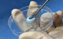 Bahan Grafting tulang